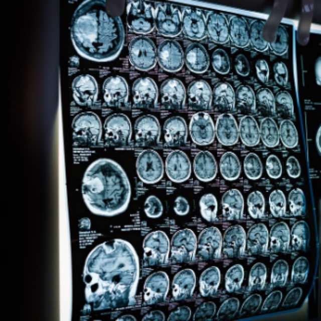 人体细胞是如何产生电信号与化学信号的？