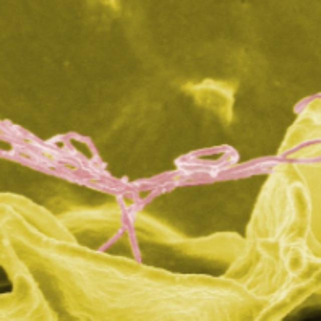 人类是如何利用微生物来抵御微生物危害的？