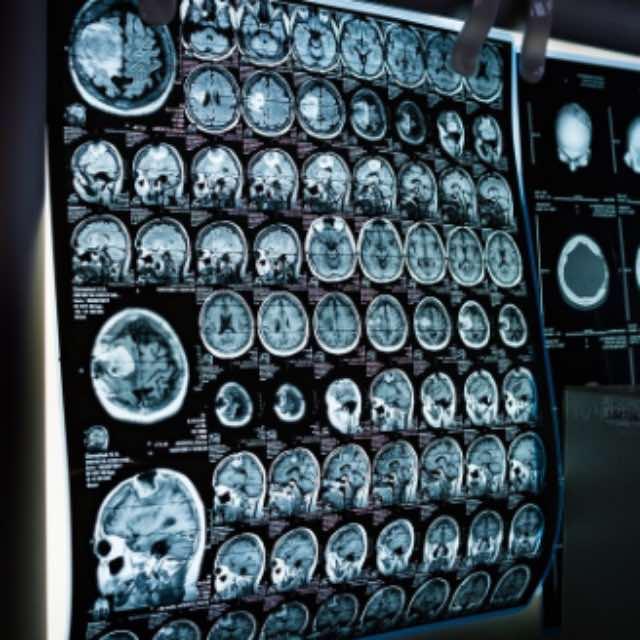 树突和树突之间能产生突触吗？