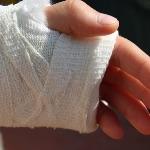 伤口愈合的时候感觉好痒怎么办？