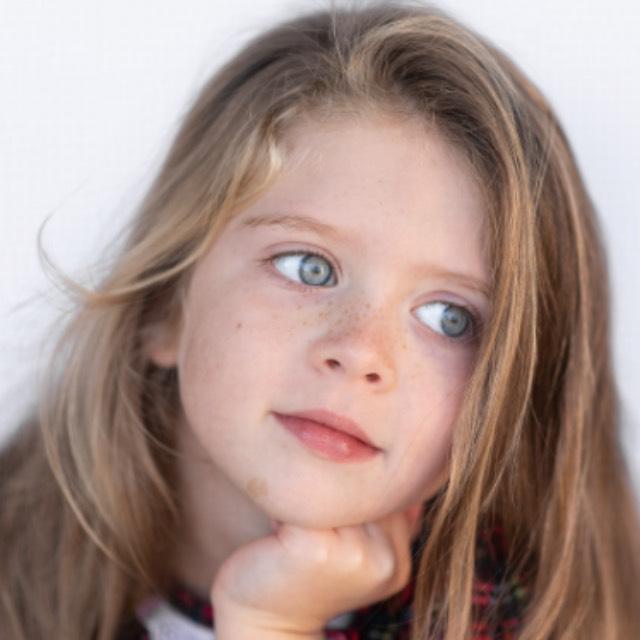 为什么人会长胎记?