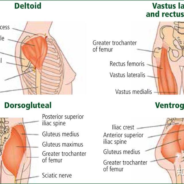 为什么现在打针都在胳膊上，屁股针几乎见不到了？