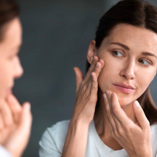 一到夏天就长痘，难道皮肤也有季节性吗？