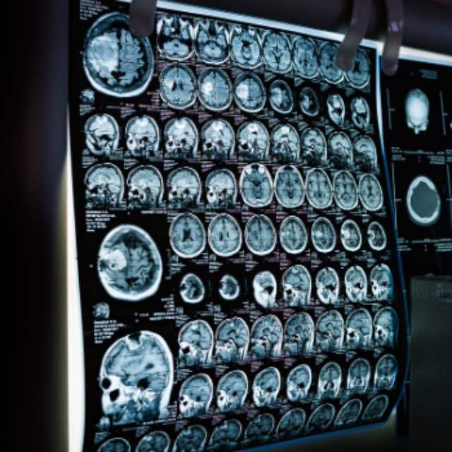 神经系统为什么要自指一个「我」出来指导肉体活动？