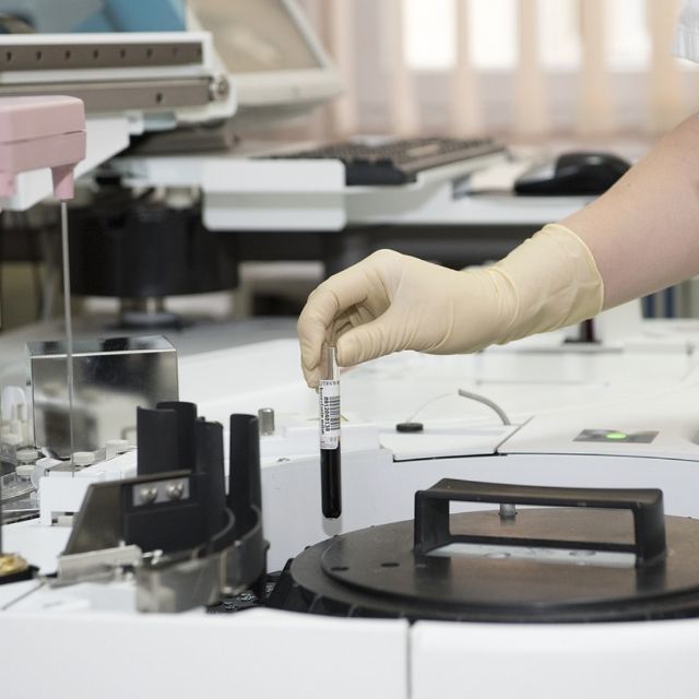 狂犬病发病后真的可以存活吗？