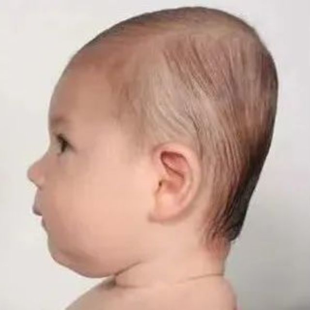 咱爸妈给咱睡个扁头的执念是哪来的？