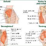 为什么现在打针都在胳膊上，屁股针几乎见不到了？